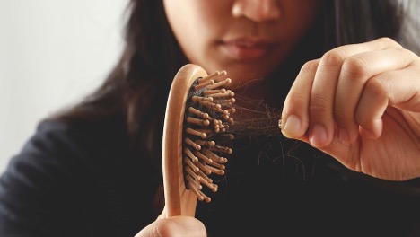 Natural Remedies for Hair Loss – Do They Really Work?